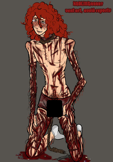 TW SELF HARM + SUICIDAL THEMES